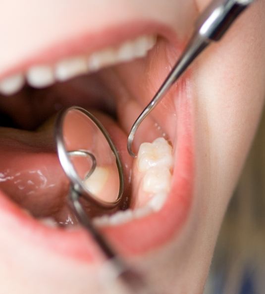 Close up of childs mouth being examined