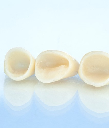 Four dental crowns sitting in row on reflective surface