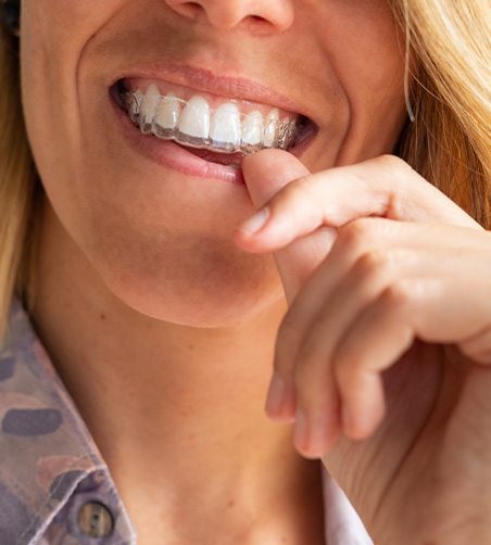 Woman wearing Invisalign