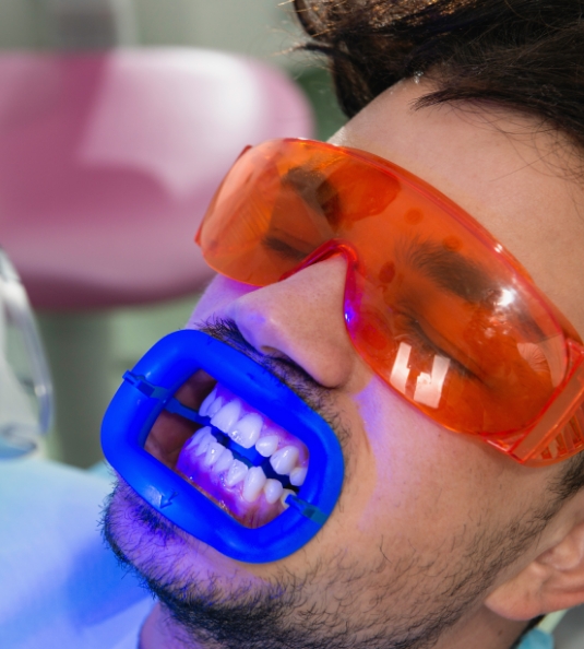 Close up of man receiving teeth whitening in dental chair