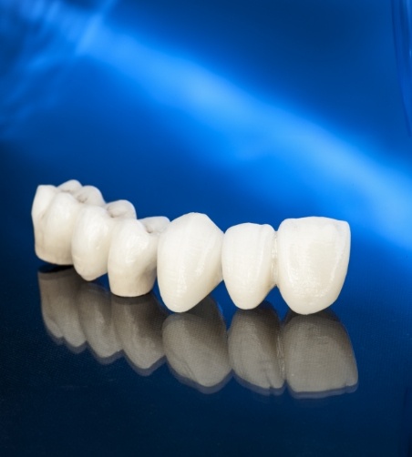 Dental bridge sitting on black surface with blue background