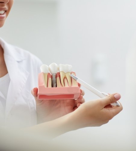 Dentist holding dental implant model and pointing to it