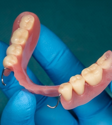 Gloved hand holding a partial denture