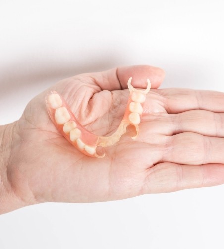 Partial denture sitting in palm of hand