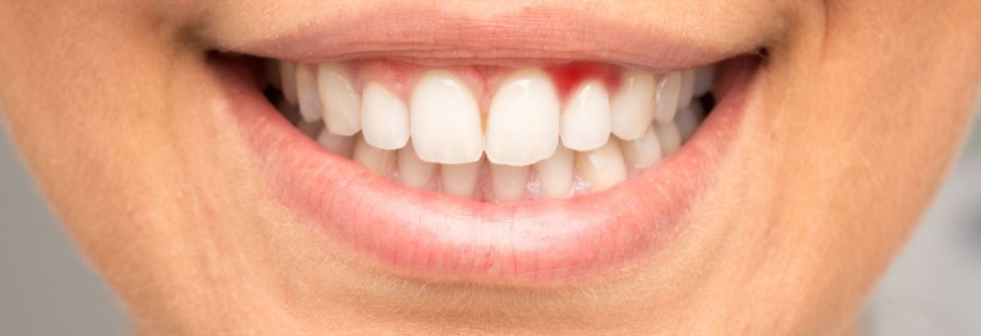 Close up of a woman smiling