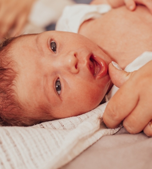 Baby lying down with parent pulling down lip