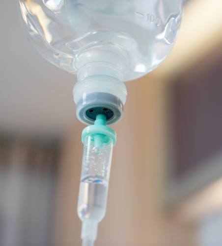 Close up of drip for IV sedation