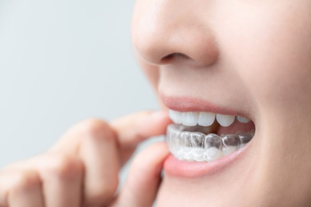 A woman putting on an Invisalign aligner.